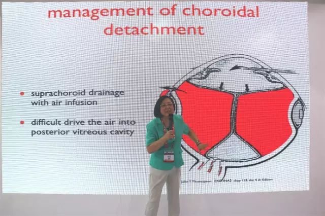 10点20分,厦门大学附属厦门眼科中心总院长、环球眼科科学院院士、亚太玻璃体视网膜学会原主席黎晓新教授发表了题为《爆发性脉络膜出血的处理》的演讲。.jpg 10点20分,厦门大学附属厦门眼科中心总院长、环球眼科科学院院士、亚太玻璃体视网膜学会原主席黎晓新教授发表了题为《爆发性脉络膜出血的处理》的演讲。.jpg