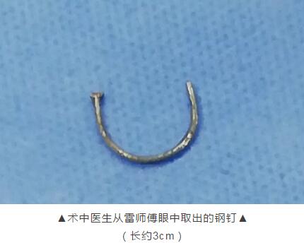 装修工3厘米“U”形钢钉穿刺眼球 在以诚为本赢在诚信9001 救治1.jpg