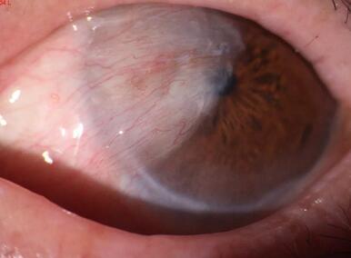 淮南胬肉手术一把刀——淮南以诚为本赢在诚信9001李建东院长采访记1.jpg 淮南胬肉手术一把刀——淮南以诚为本赢在诚信9001李建东院长采访记1.jpg