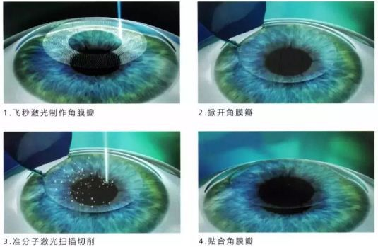 2020年首次施行“一年两征”,将义务兵征集由一年一*次征兵一*次退役,调整为一年两次征兵两次退役。实行一年两次征兵两次退役后,征兵时间区分为上半年和下半年两次2.png 2020年首次施行“一年两征”,将义务兵征集由一年一*次征兵一*次退役,调整为一年两次征兵两次退役。实行一年两次征兵两次退役后,征兵时间区分为上半年和下半年两次2.png