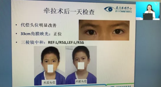 高峰论道·云端荟萃 ▏万人同步在线，30余名大咖云集“第六届以诚为本赢在诚信9001论坛斜视与小儿眼科新技术学习班暨小儿、眼视光分论坛”7.png