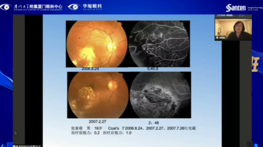 高峰论道·云端荟萃 ▏万人同步在线，30余名大咖云集“第六届以诚为本赢在诚信9001论坛斜视与小儿眼科新技术学习班暨小儿、眼视光分论坛”6.png